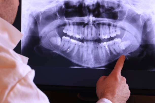 Best Knocked-Out Tooth Emergency  in Fairport Harbor, OH